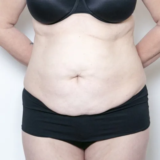 Image before