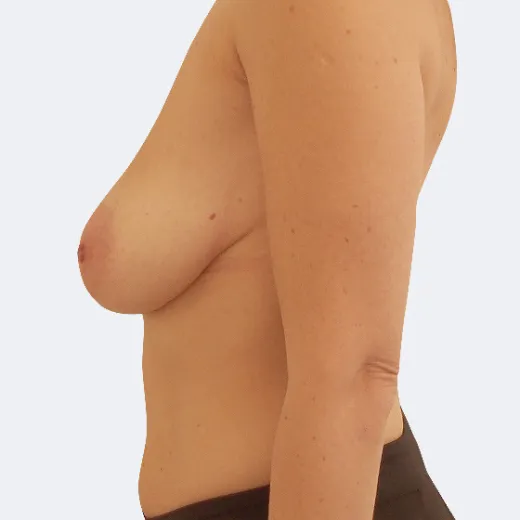 Image before