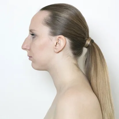 Image before