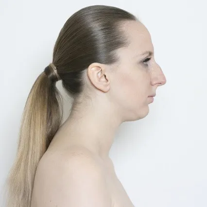 Image before