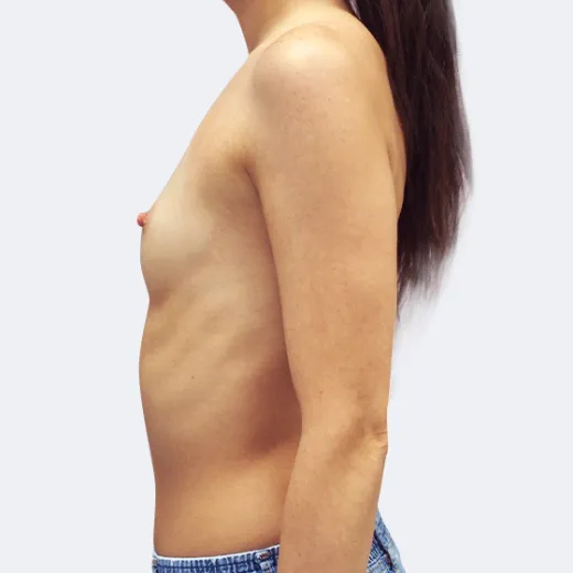 Image before