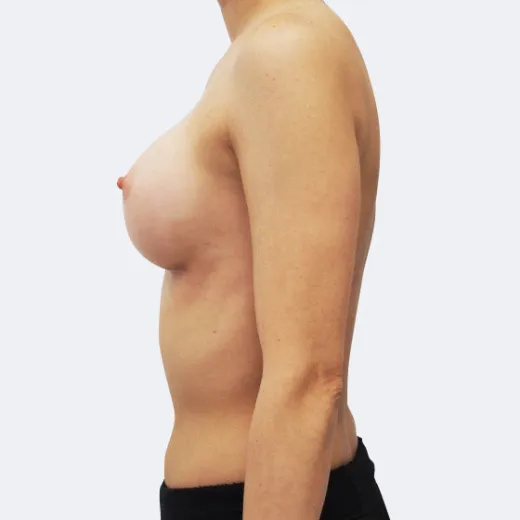 Image after