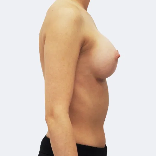 Image after
