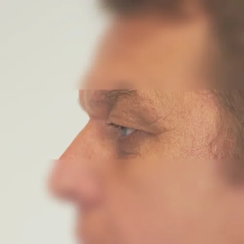Image before