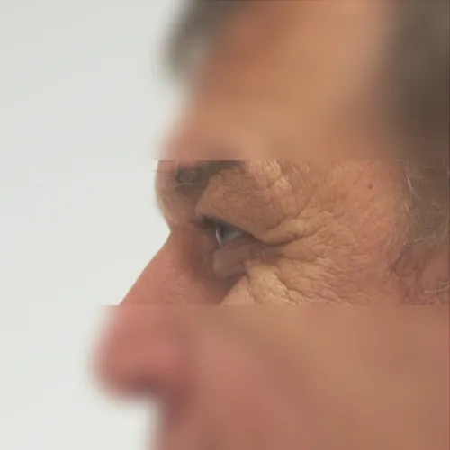 Image after