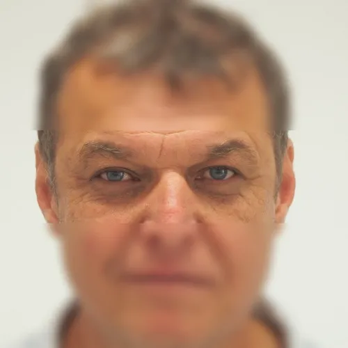 Image after