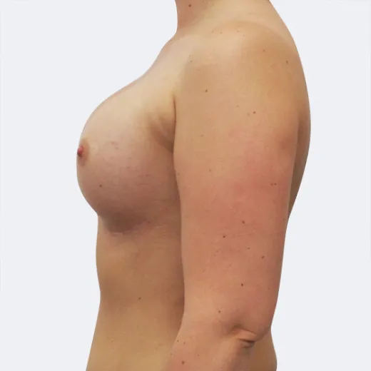 Image after