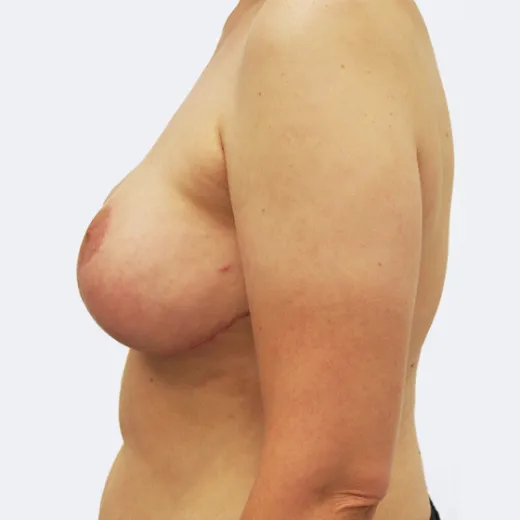 Image after