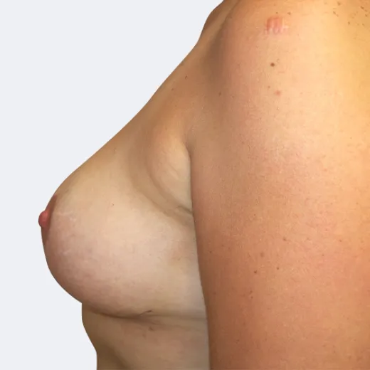 Image after