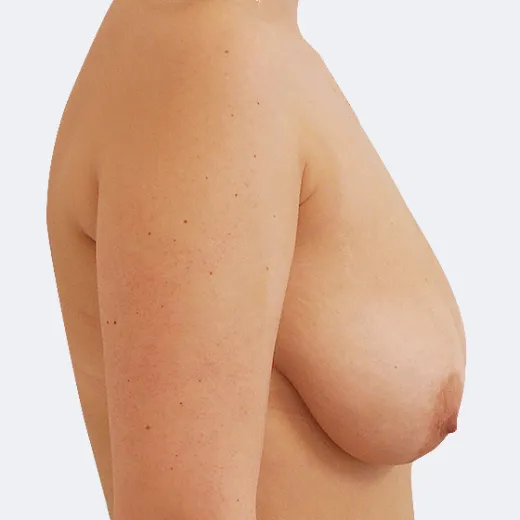Image before