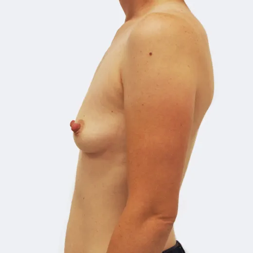 Image before
