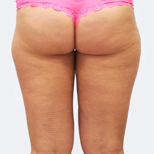 Image after