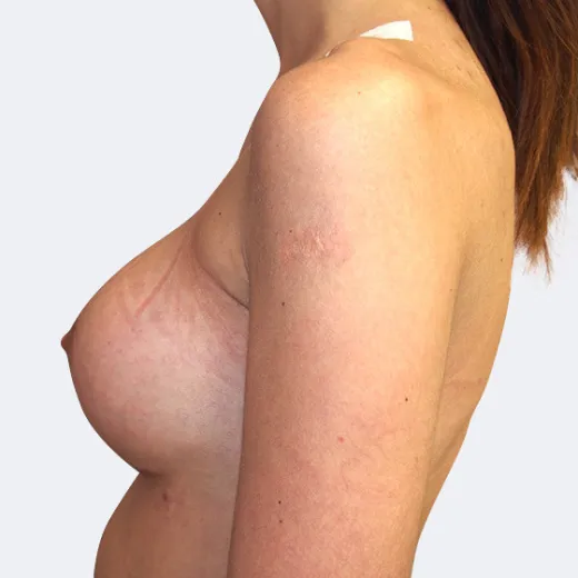 Image after