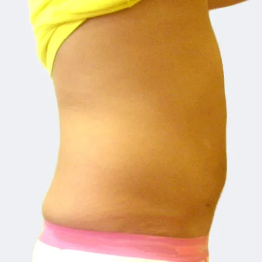 Image after