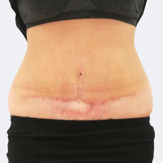 Image after