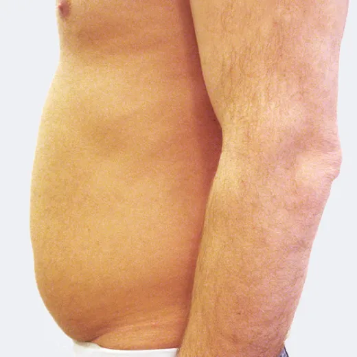 Image before