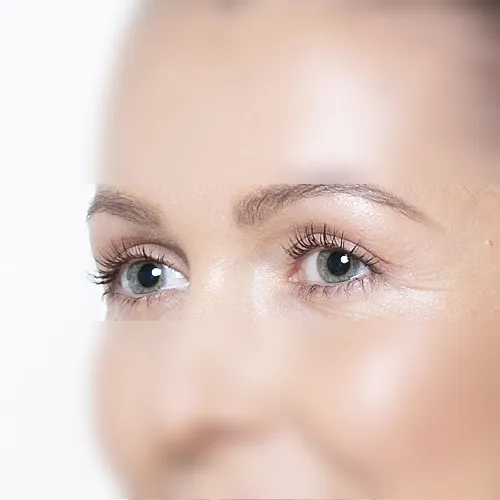 Image after