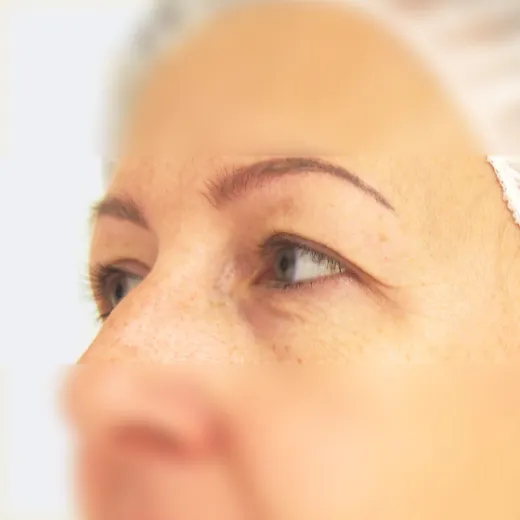 Image before
