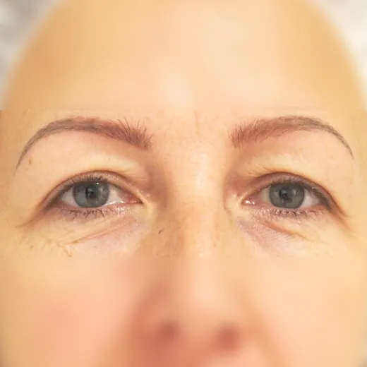 Image before