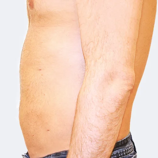 Image after