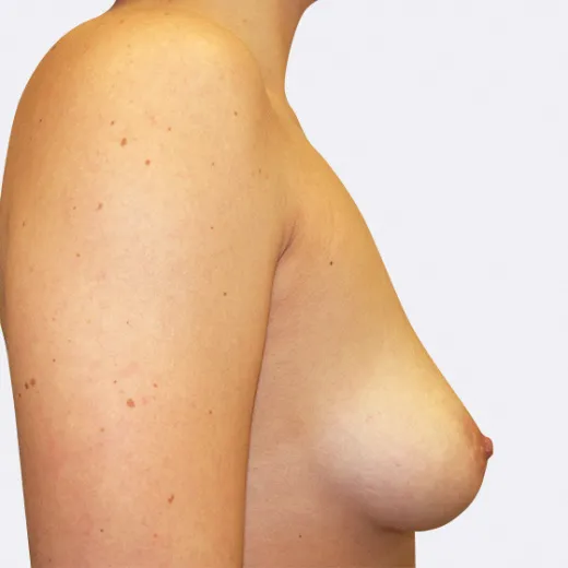 Image before