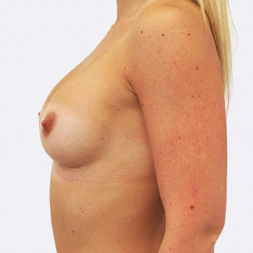 Image after