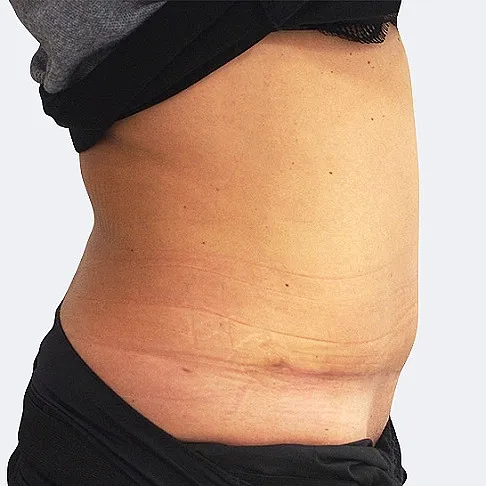 Image after