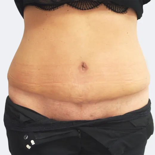Image after