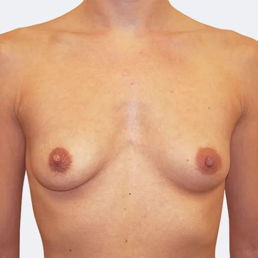 Image before
