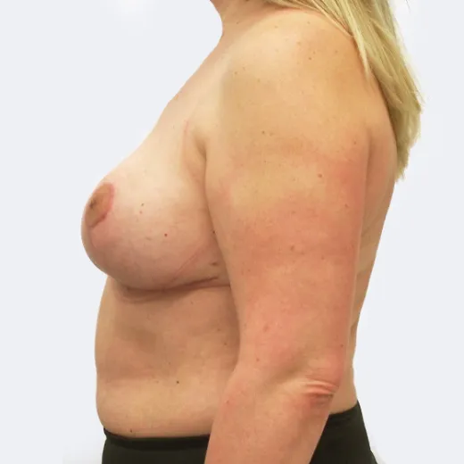 Image after
