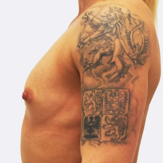 Image before