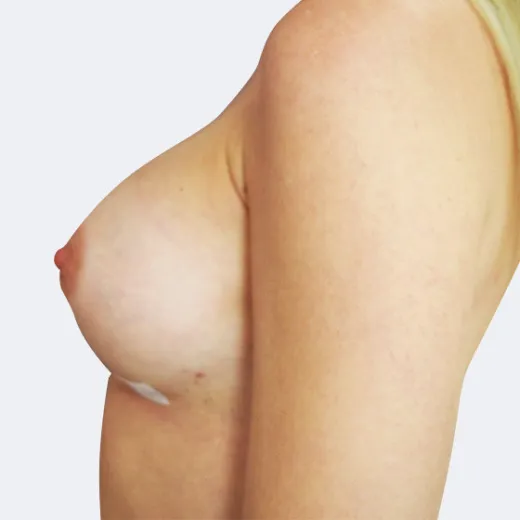 Image after