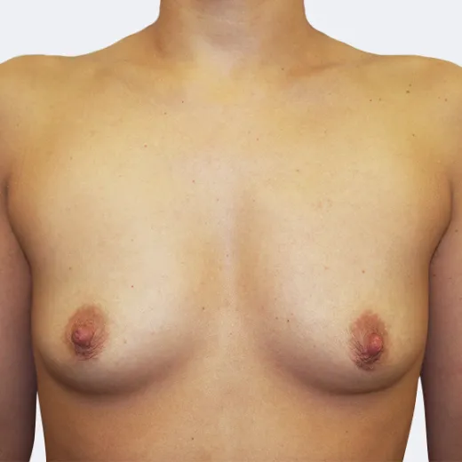 Image before