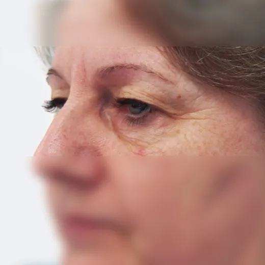 Image before