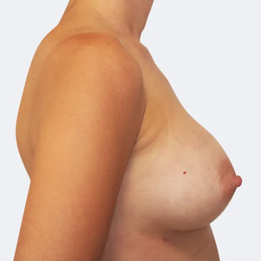 Image after