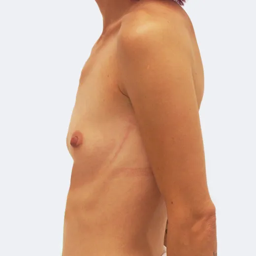Image before