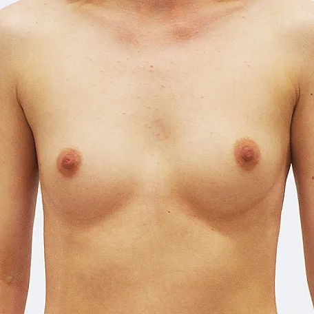 Image before