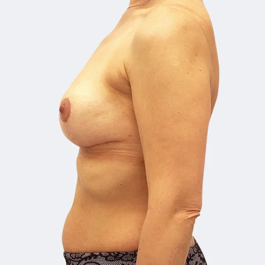 Image after