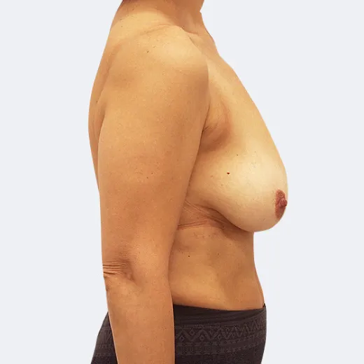 Image before