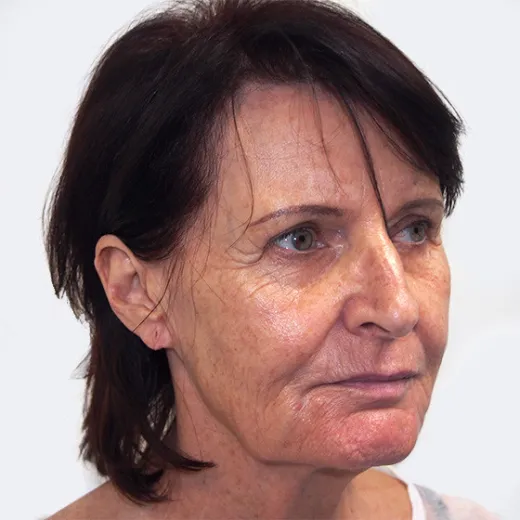 Image before