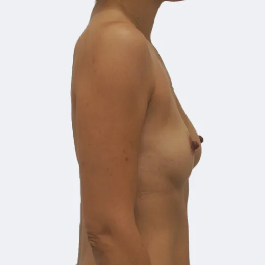 Image before