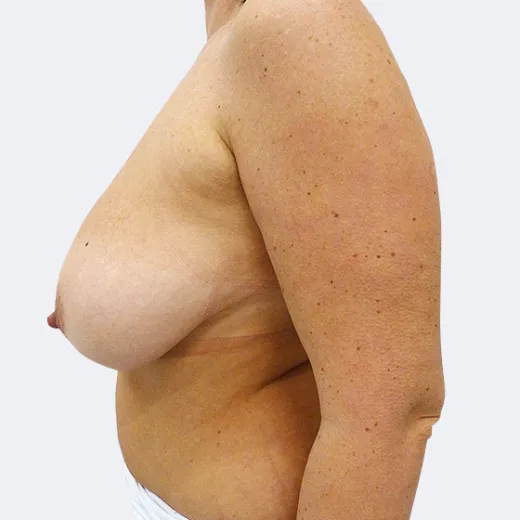 Image before