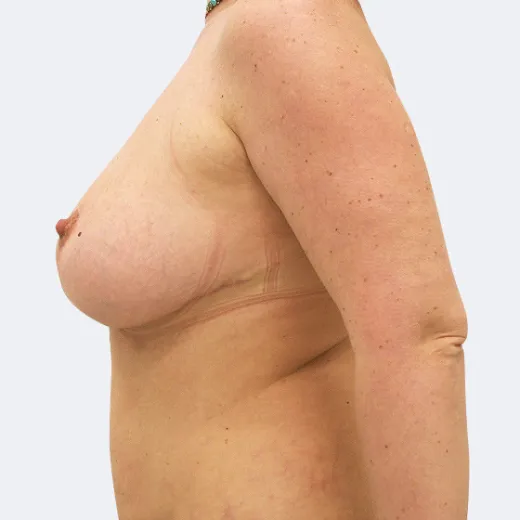 Image after