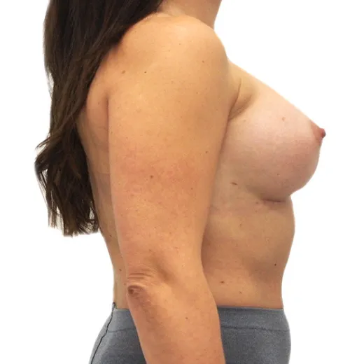 Image after