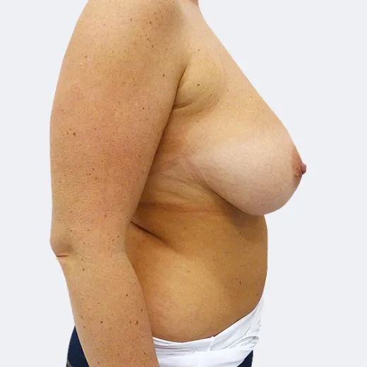 Image before