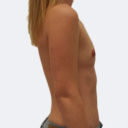 Image before