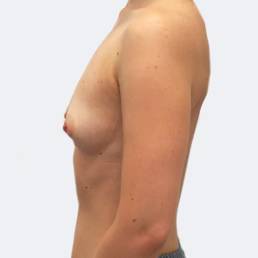 Image before