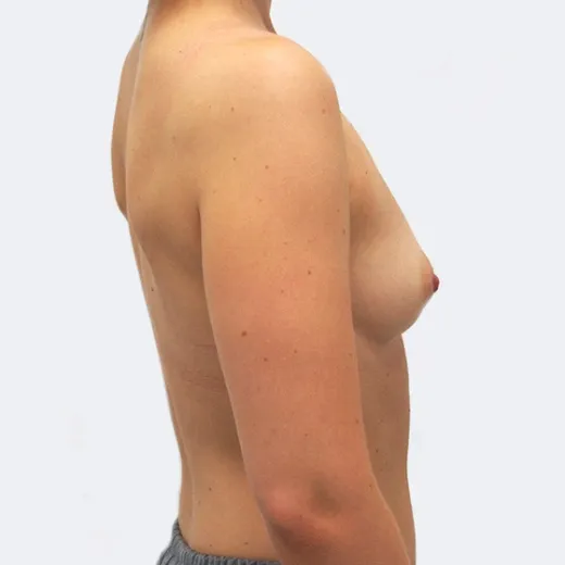 Image before