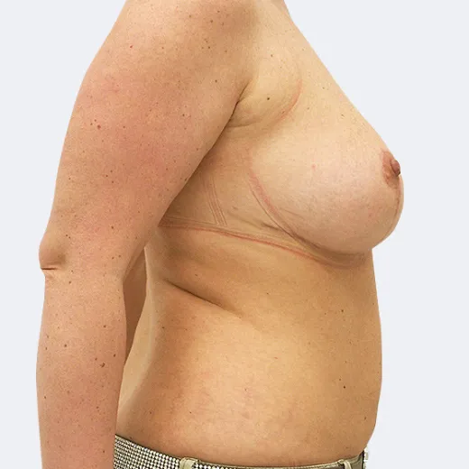 Image after