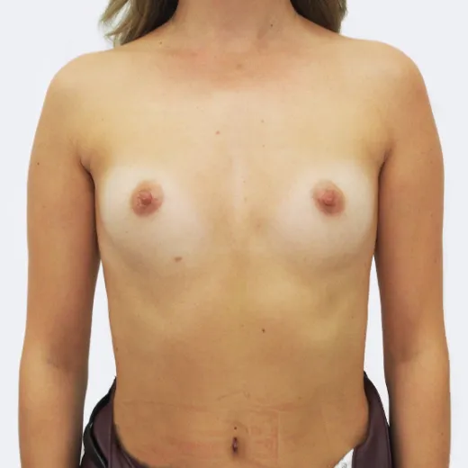 Image before